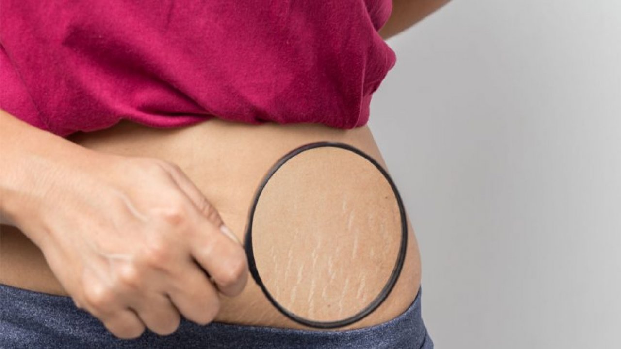 Çatlaklara Bitkisel Çözüm