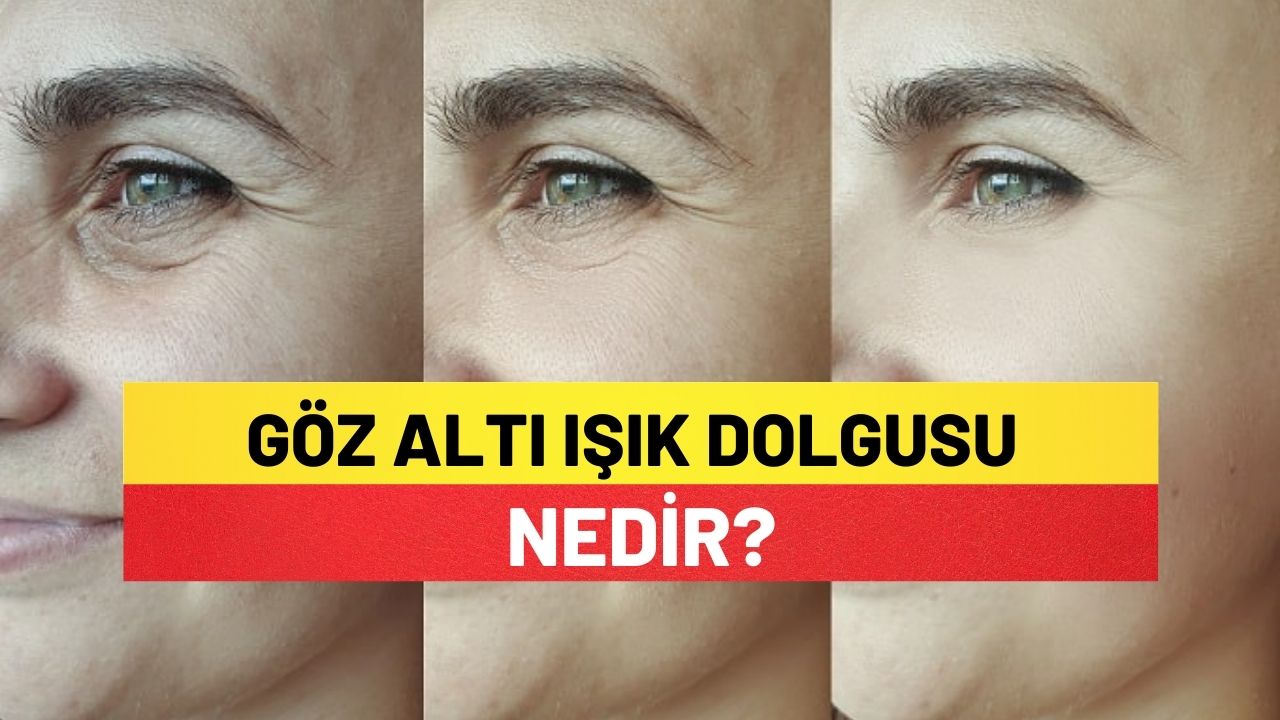 Göz Altı Işık Dolgusu Nedir?