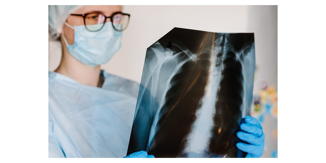 Kronik Obstrüktif Akciğer Hastalığı (KOAH) Nedir? Dünya KOAH Günü