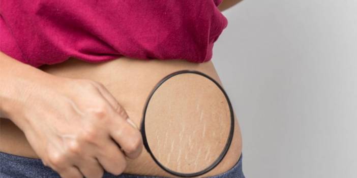 Çatlaklara Bitkisel Çözüm