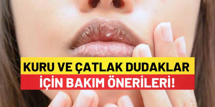 Kuru ve Çatlak Dudaklar İçin Bakım Önerileri!