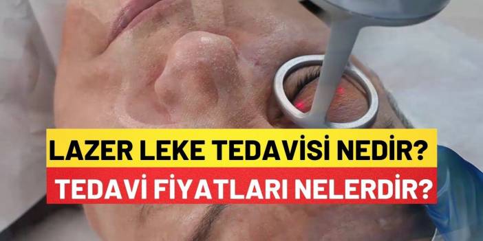 Lazer Leke Tedavisi Nedir Leke Lazer Tedavisi Fiyatları Nelerdir