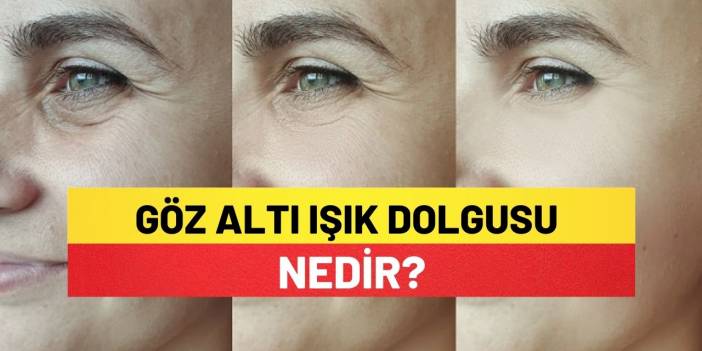 Göz Altı Işık Dolgusu Nedir?