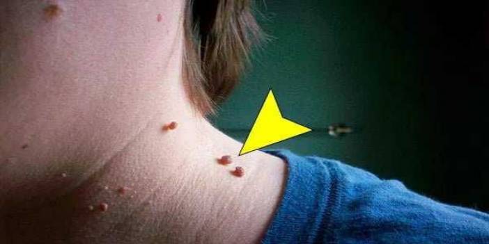 Et Benlerinizi Dökecek En Etkili Tarif